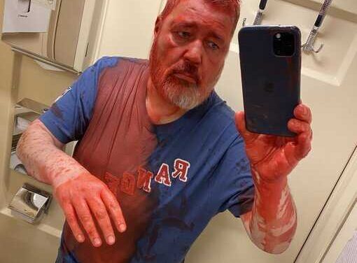 Az orosz titkosszolgálat állhat a Nobel-díjas orosz újságírót ért támadás mögött